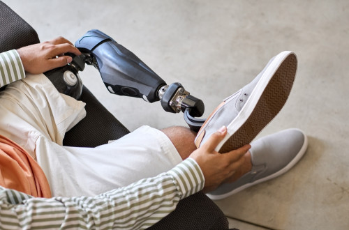 Osoba s protézou nohy sedí na židli, má na sobě světlé šortky a pruhované tričko, drží tenisku a chystá se ji nasadit na protézu.